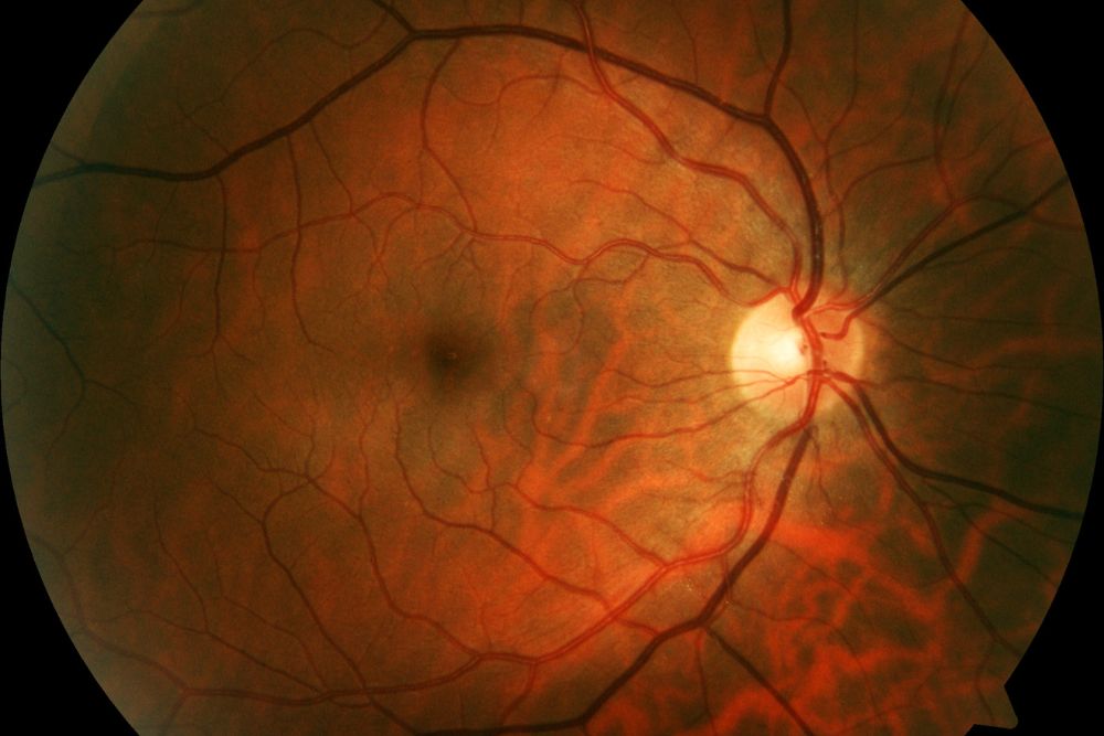 trec retina vascular system